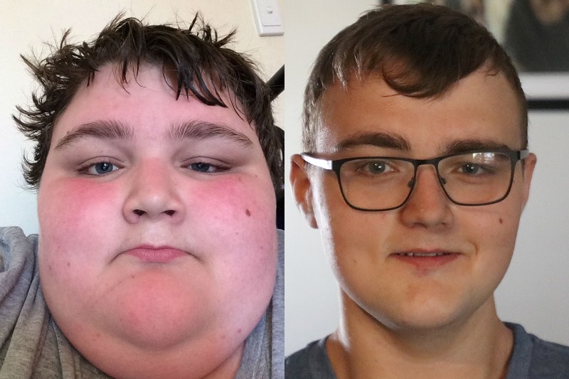 A composite image of Jack Butcher before and after surgery.