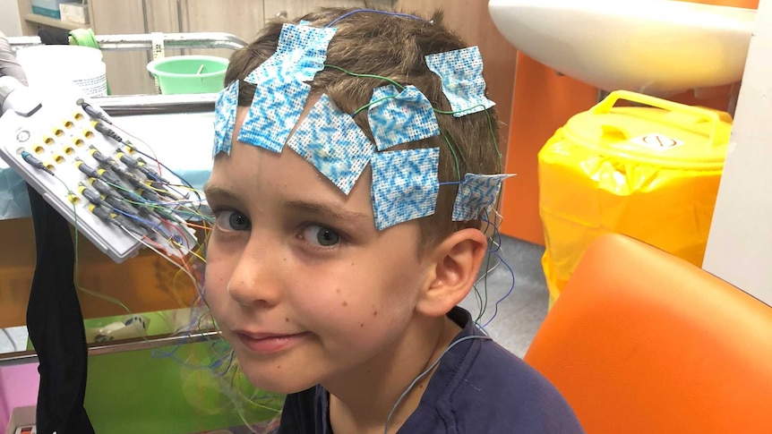 Lewis Railton smiling to camera with patches and wires on his head at the hospital.