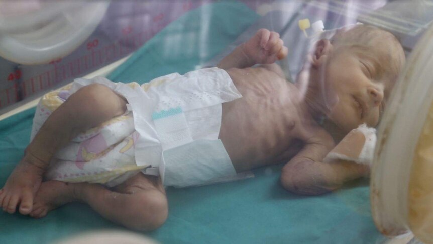 Baby in Al Sabheen hospital