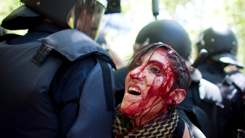 Protester injured during clashes between riot police and supporters of Spanish coal miners.