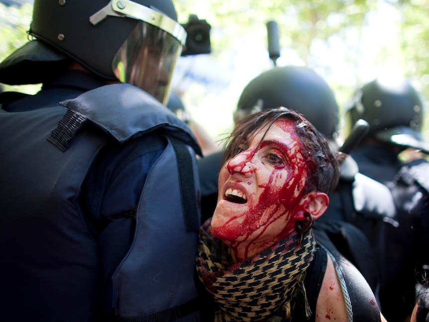 Protester injured during clashes