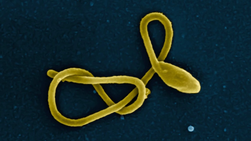 Ebola virus particle