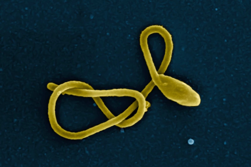 Ebola virus particle