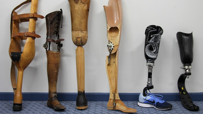 how nasa was used for prosthetic limbs