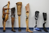 Caulfield prosthetics from 1915 to 2015