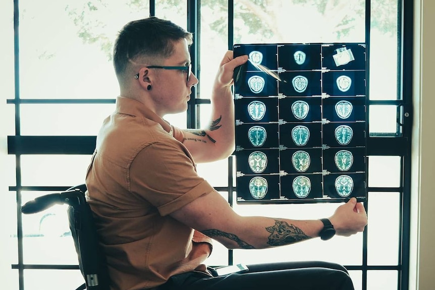 A person in a wheelchair holds up some brain scans