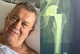 A composite image of Jimmy Barnes in a hospital bed and an x-ray of a hip replacement. 