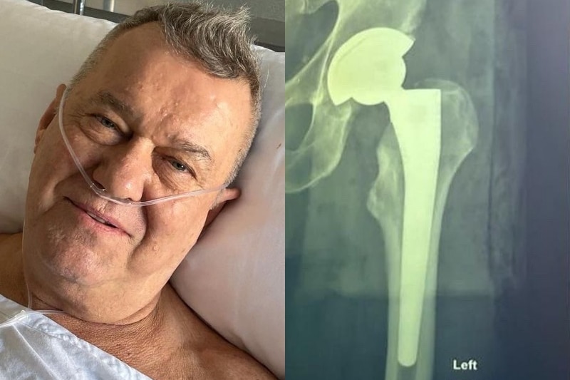 A composite image of Jimmy Barnes in a hospital bed and an x-ray of a hip replacement. 