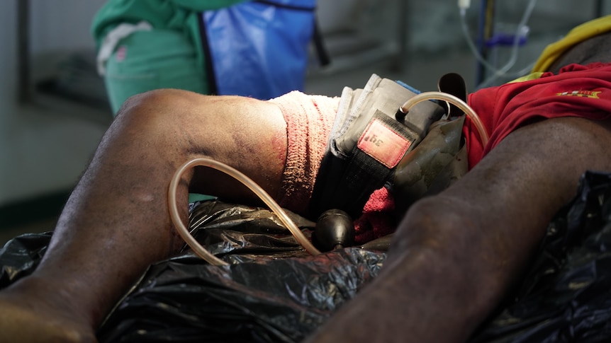 A close-up of a man's upper thigh shows it wrapped in bandages to stop bleeding. He appears to be lying on black plastic