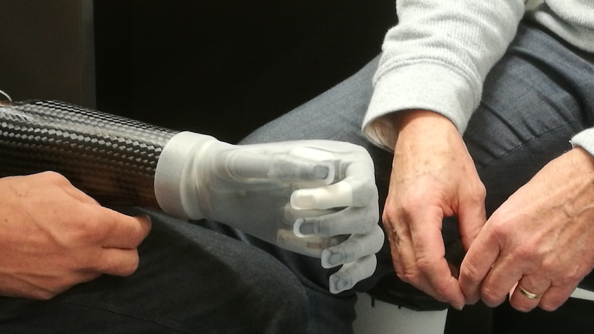 A black prosthetic arm with a robotic hand is resting on Leroy's knee.