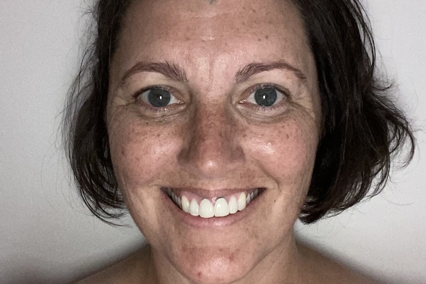 A photo of a woman with a big smile, brown hair and freckles. 