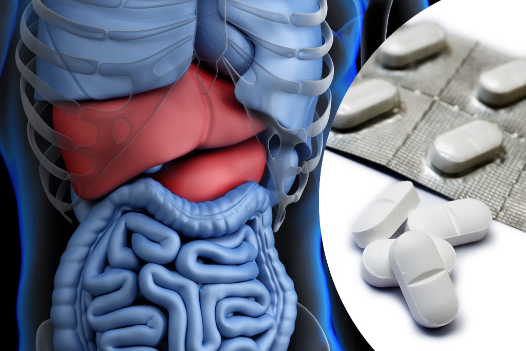 Codeine medications Pain and gain when products pulled from shelves