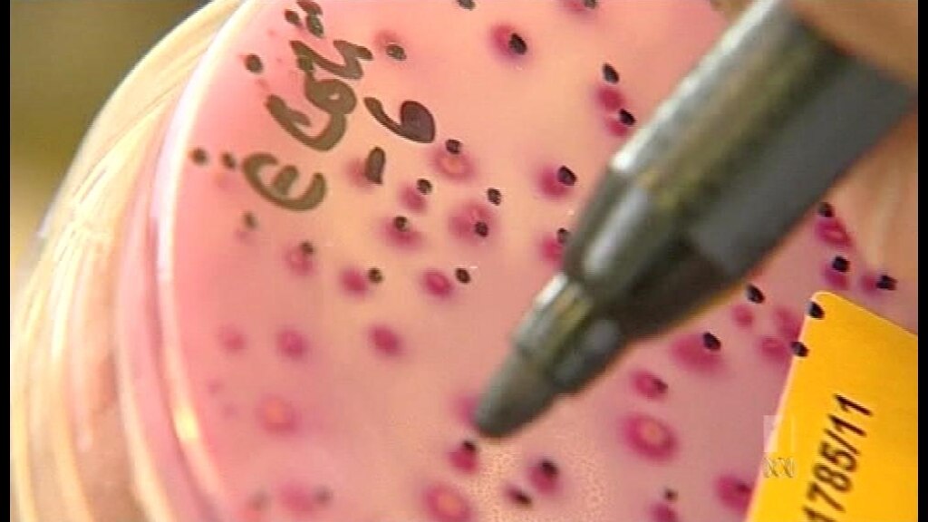 E. coli outbreak traced to Germany - ABC News