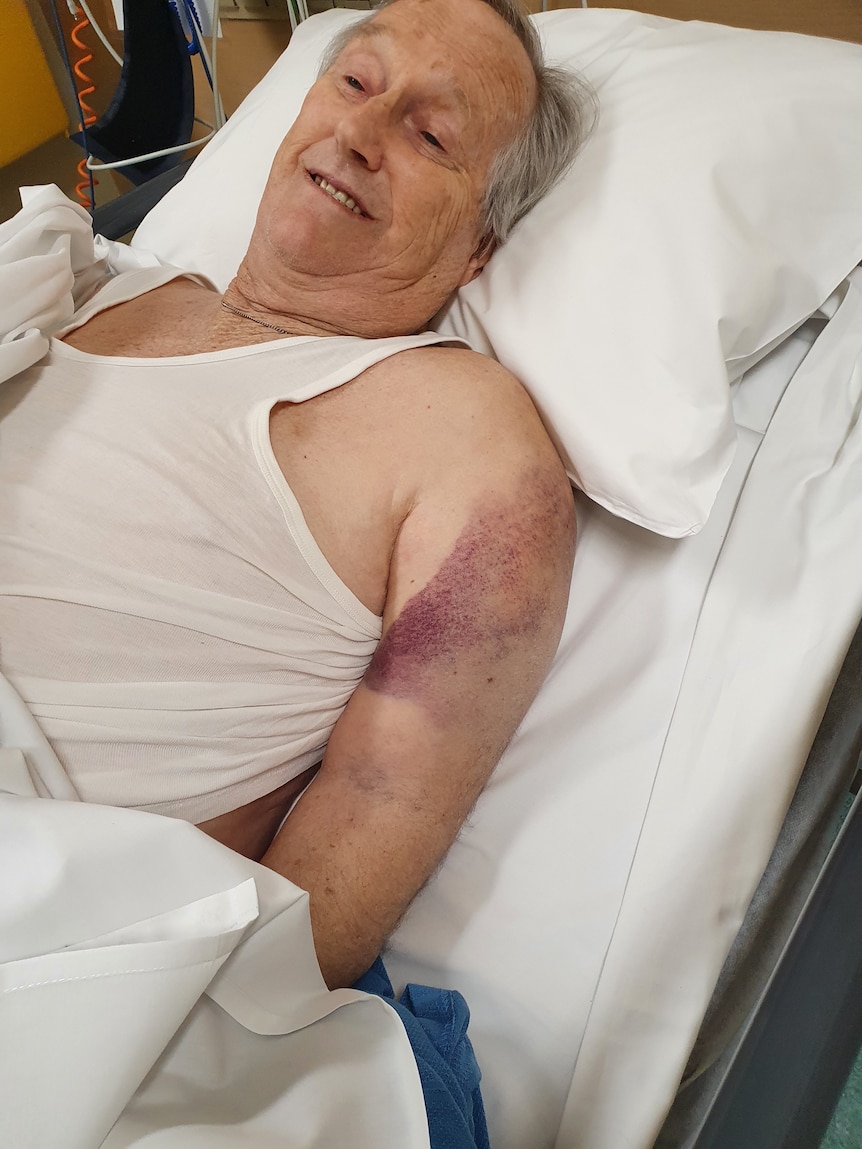 A man in a hospital bed with a bruised arm