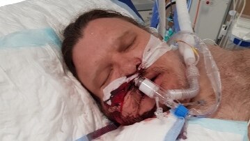 Phillip Stennett spent weeks in an intensive care unit in Newcastle after he was shot in the face.