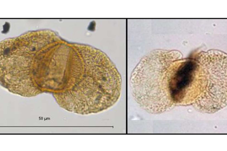 Two magnified images of pollen. The image on the right is lighter but has darker colour in its centre.