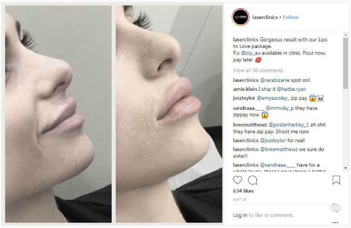 A post on the Laser Clinic Instagram account tells followers: "PS @Zip_au available in clinic. Pout now, pay later."