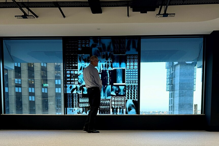 A man stands at a high-rise office window looking at dozens of x-rays on the window.