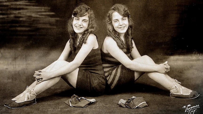 Conjoined twins Daisy and Violet Hilton sit side by side.