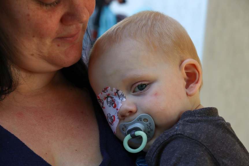 A baby with a patch on his eye looks at the camera.