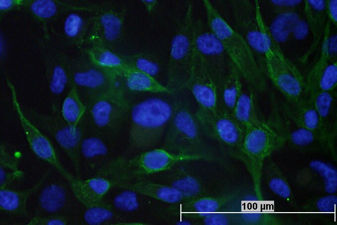 Immunofluorescent-labeled melanoma cells
