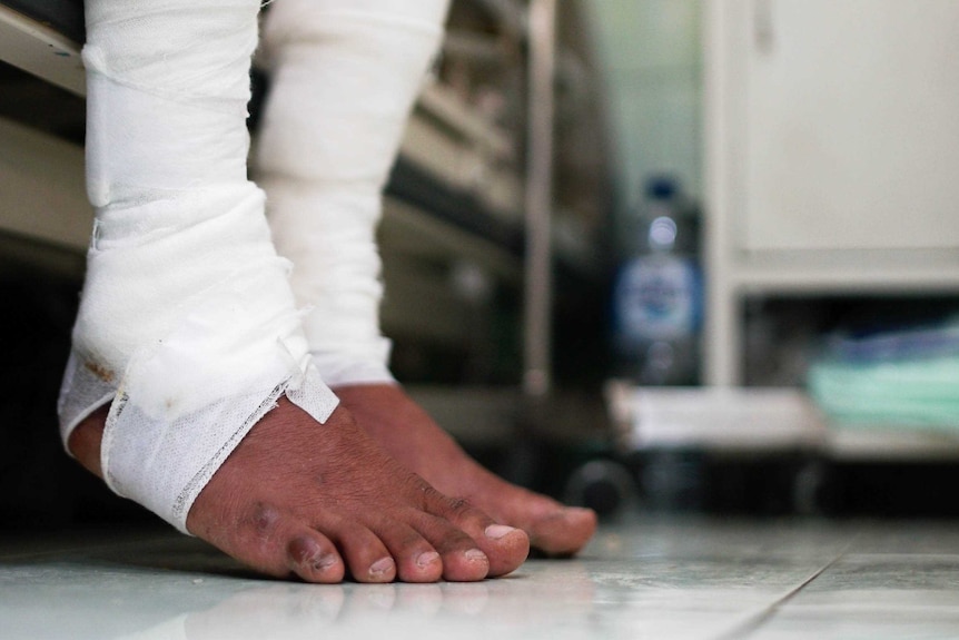 Bandaged feet hang over a hospital bed