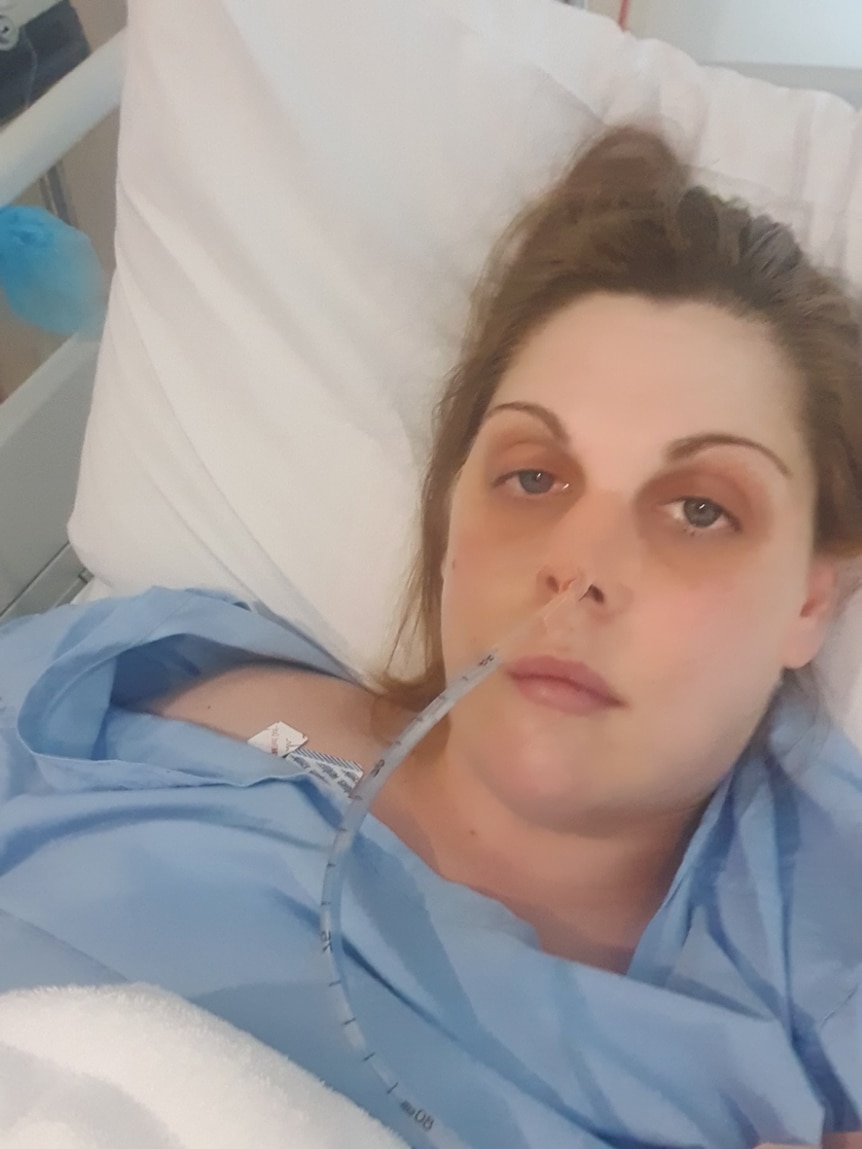 A woman lays in a hospital bed with a tube up her nose.