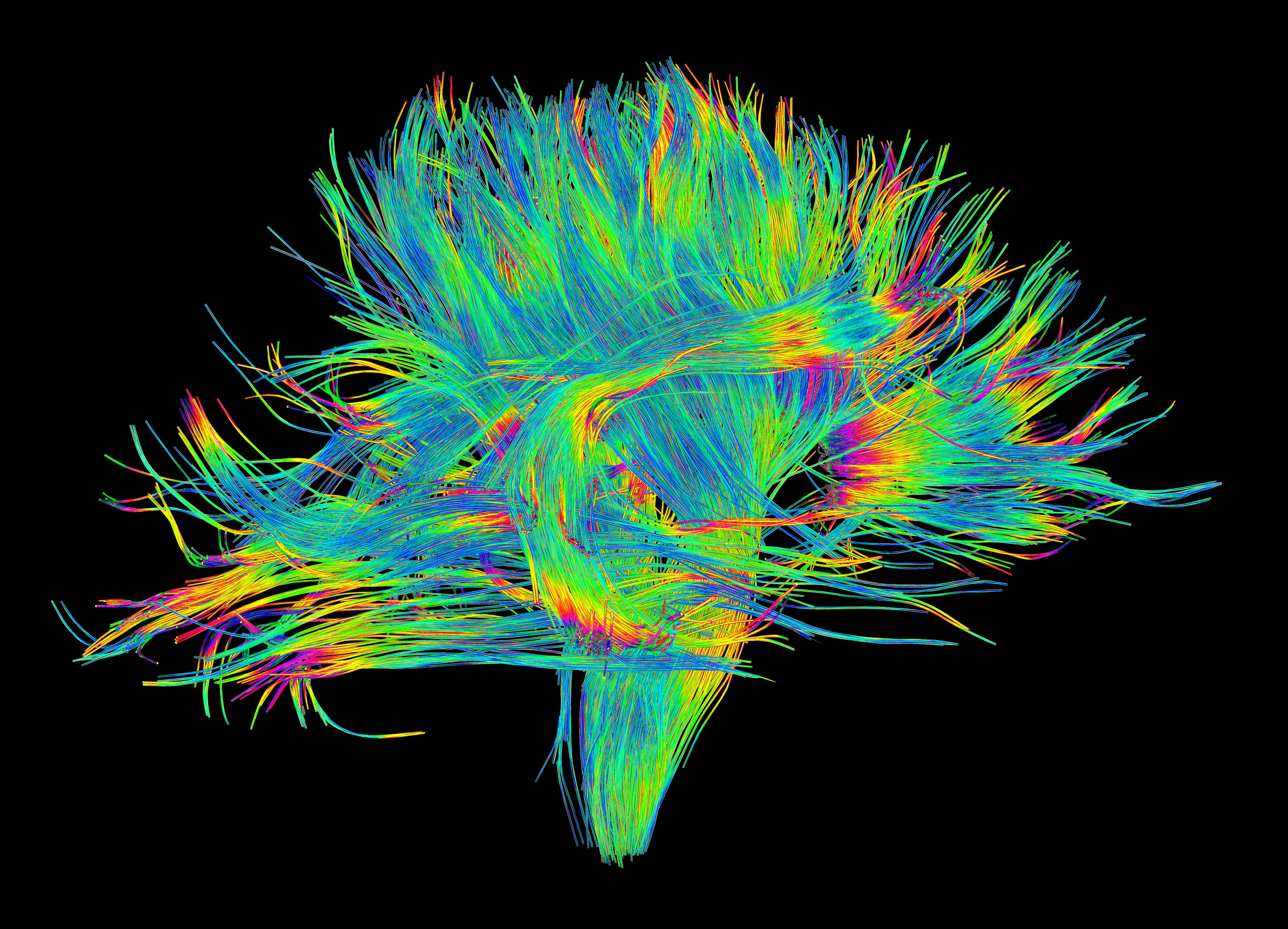 DSI image of the white matter fibres of the brain. 