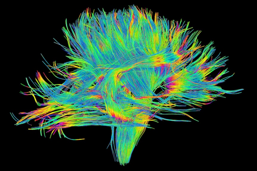 DSI image of the white matter fibres of the brain. 