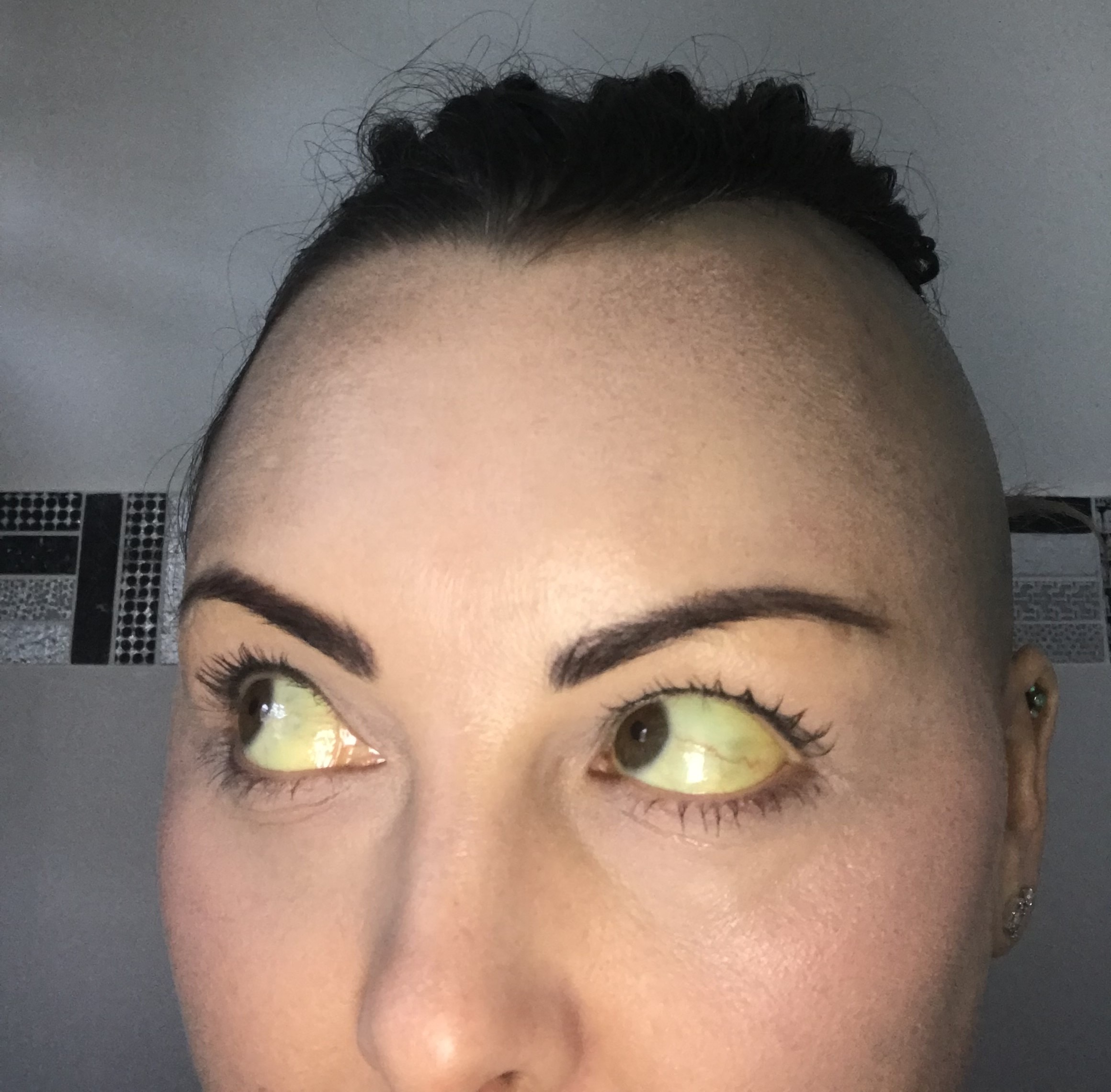 Close up of woman's eyes which are yellow