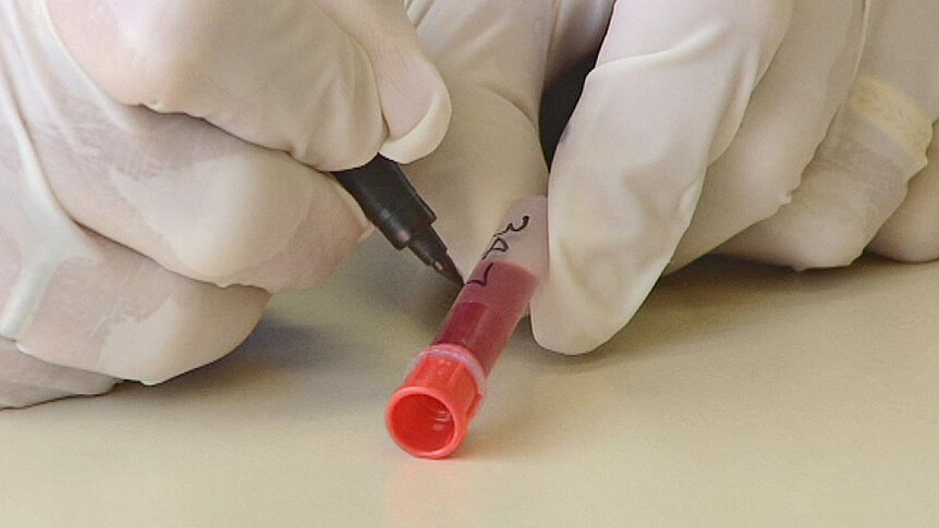 A small plastic vial filled with blood is marked with a black marker held by a gloved hand