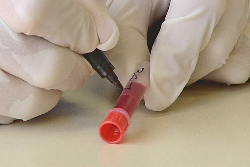 A small plastic vial filled with blood is marked with a black marker held by a gloved hand