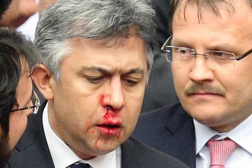 Turkish politician suffers blood nose