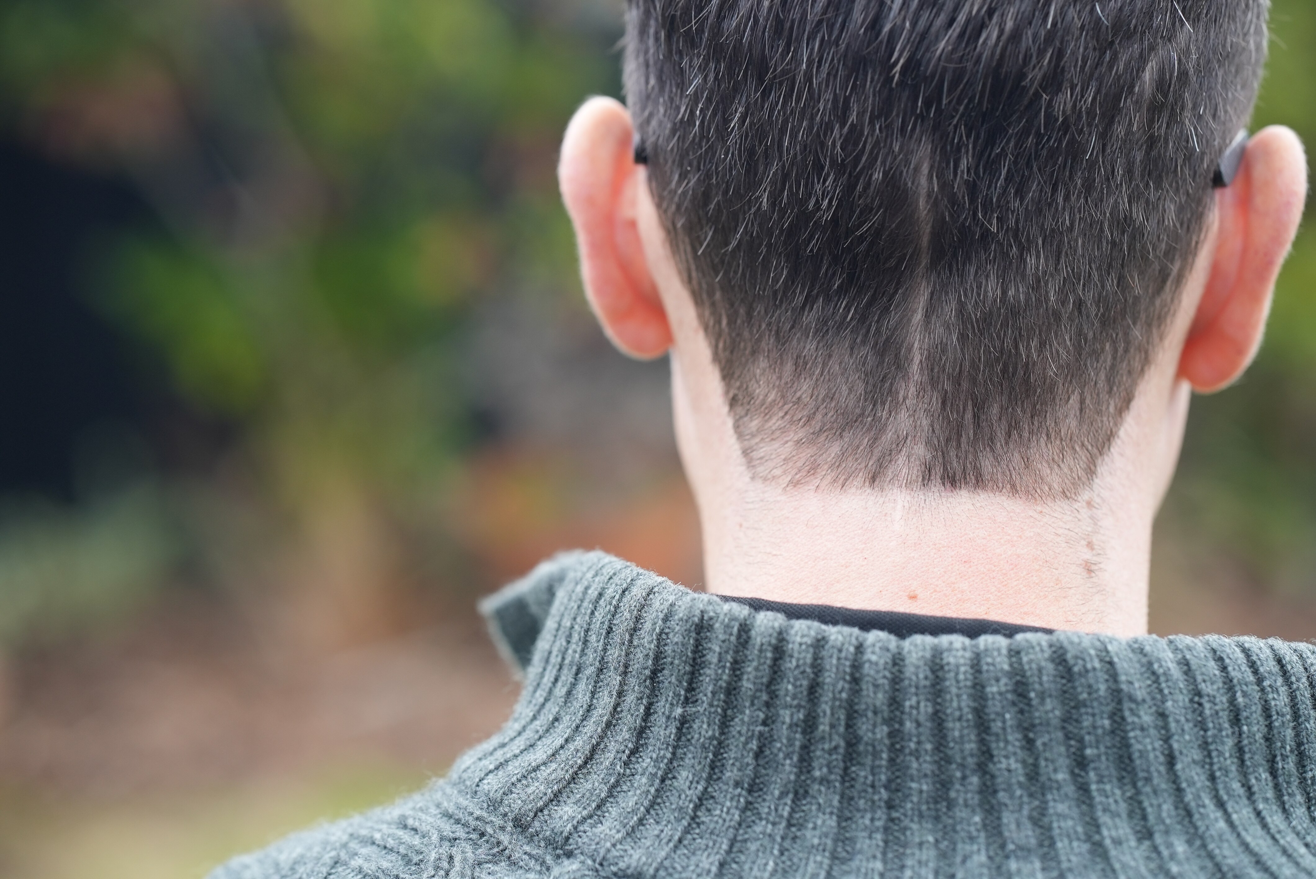 A close up shot of stroke survivor Paul burns, facing away from the camera, showing a long scar down the back of his head