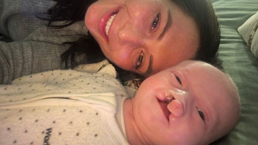 Lana is lying next to her baby. Lana has dark hair and is smiling. The baby has a bilateral cleft palette and is also smiling