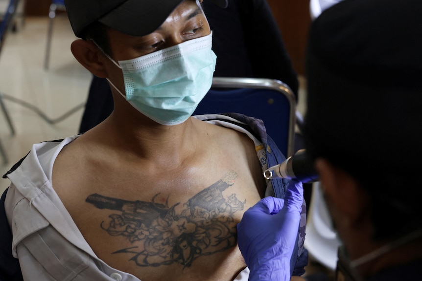 Man getting a tattoo on his chest removed.