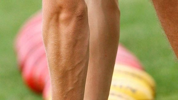 The AFL has been lambasted for allowing young men to return two positive tests without their names being made public.