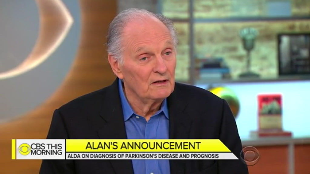 Alan Alda Mash Star Reveals He Has Parkinson S Disease Abc News