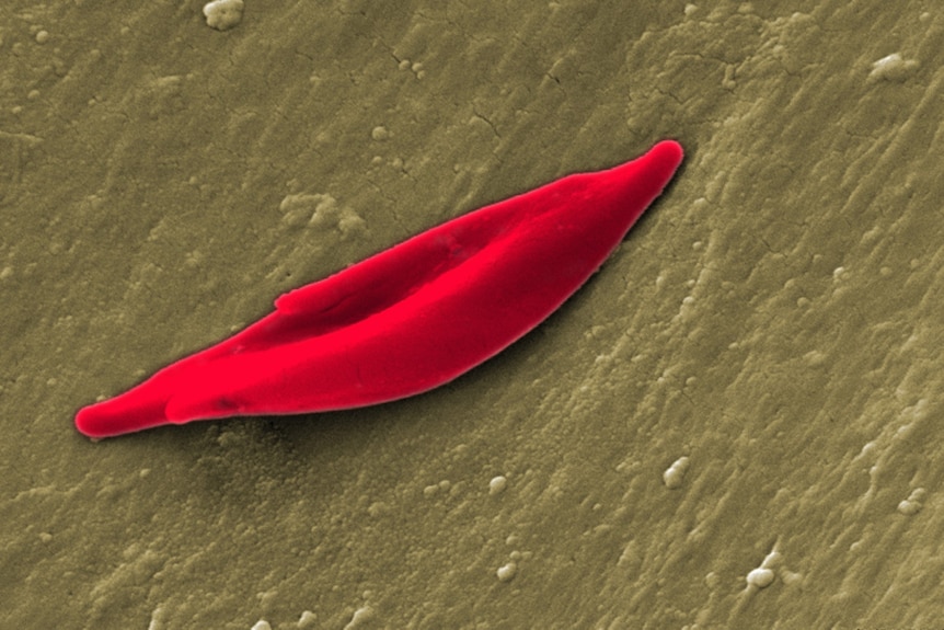 An elongated red blood cell on a brown background