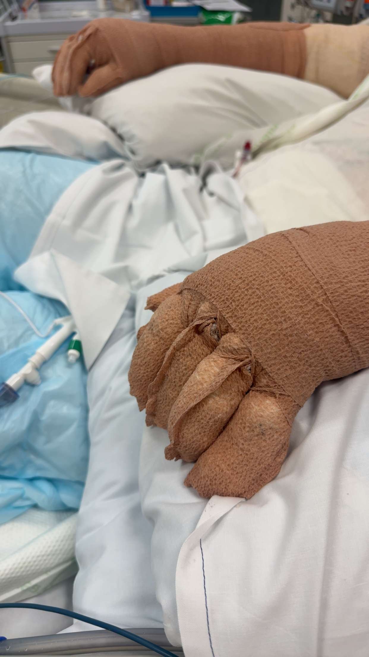 Un primer plano de una mano vendada.