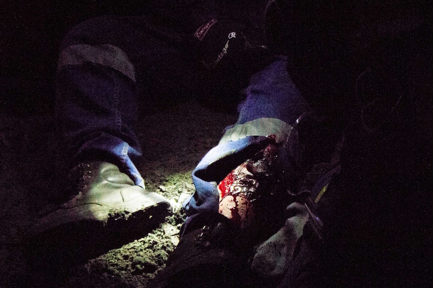 One of the "injuries" team members were confronted with during the first aid exercise at the 2015 Mines Rescue Competition.