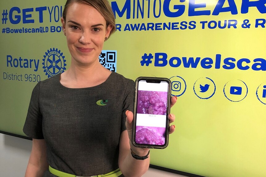 A young, blonde woman holding her phone with a photo of the polyps on her lower bowel.