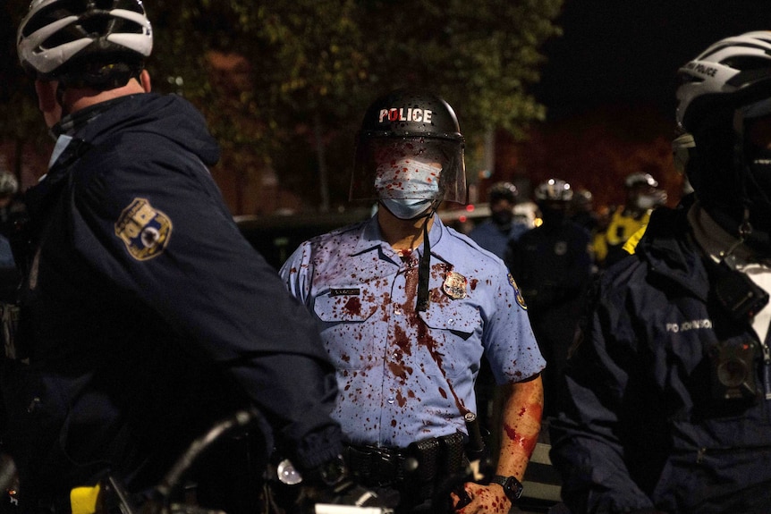 A police officer in a helmet and facemask stands with his shirt covered in blood.