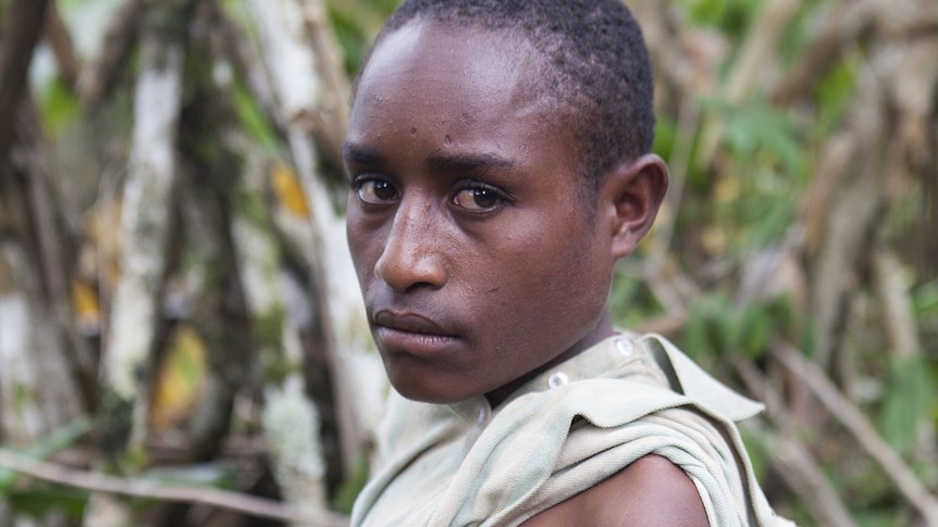Robert Lepo, 11, shows his arm amputated from the elbow down. He was attacked with machetes during a 2013 tribal war in PNG.