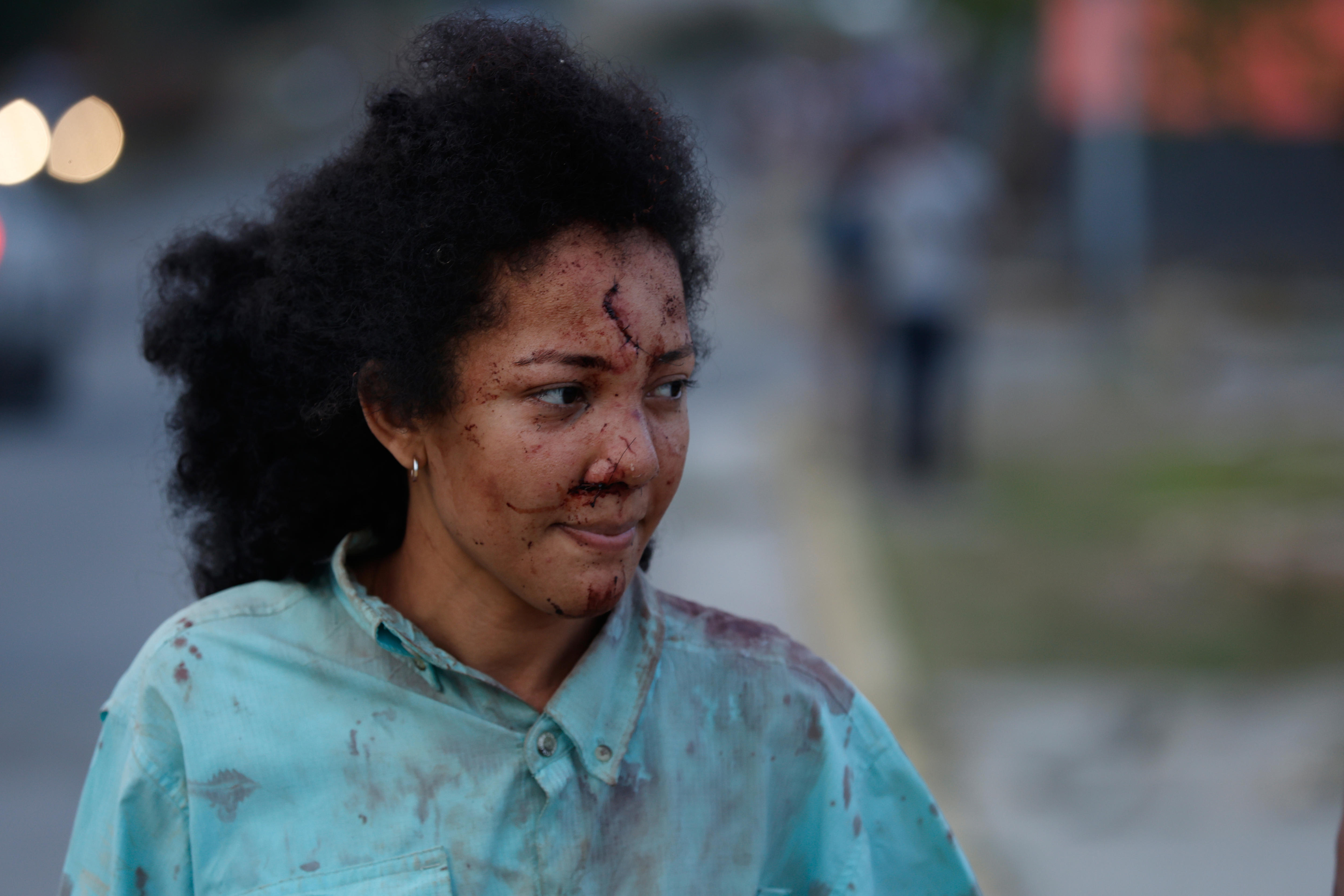 a woman with blood on her face and shirt 