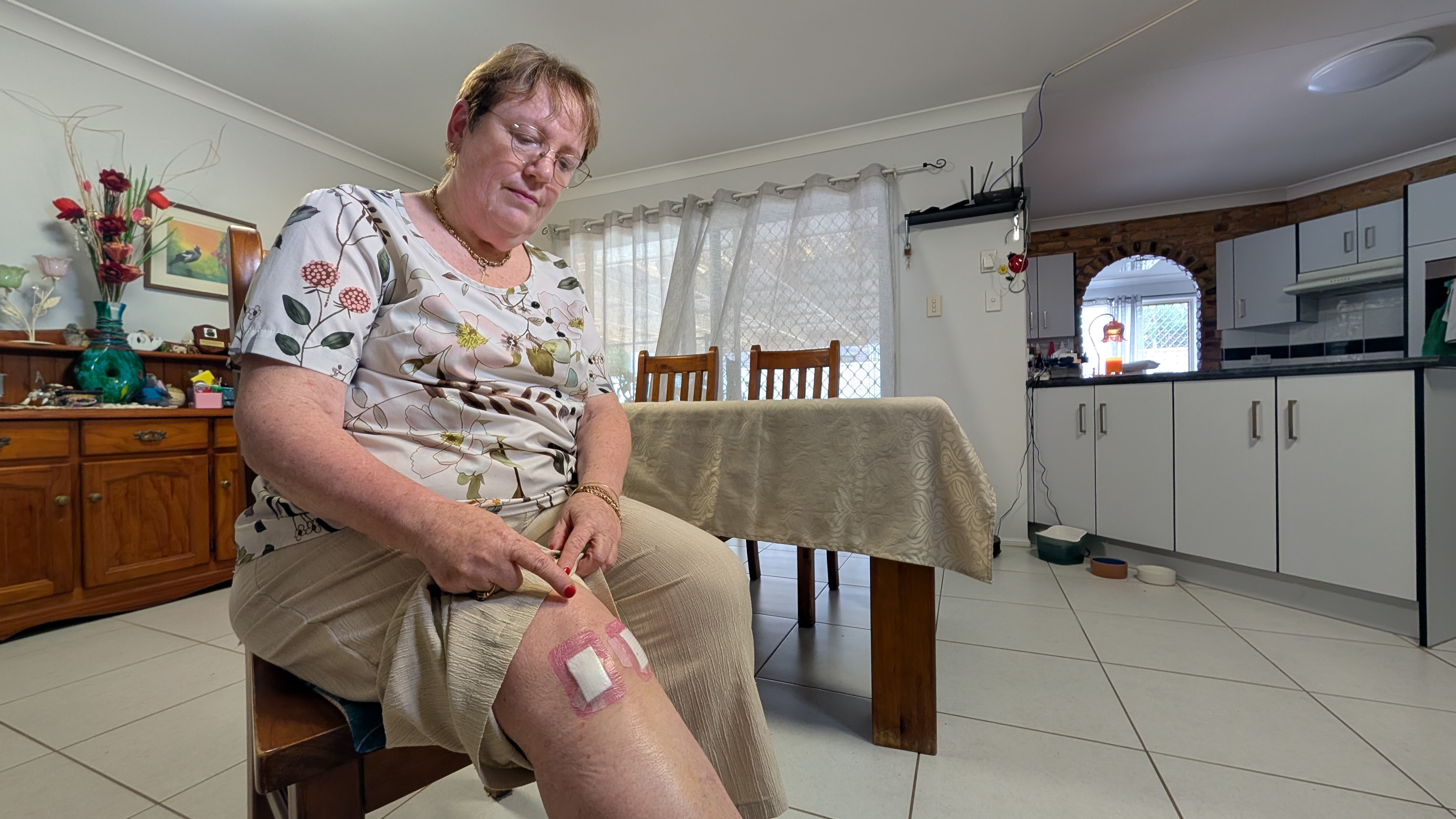 A woman sitting and looking at bandages on her knee