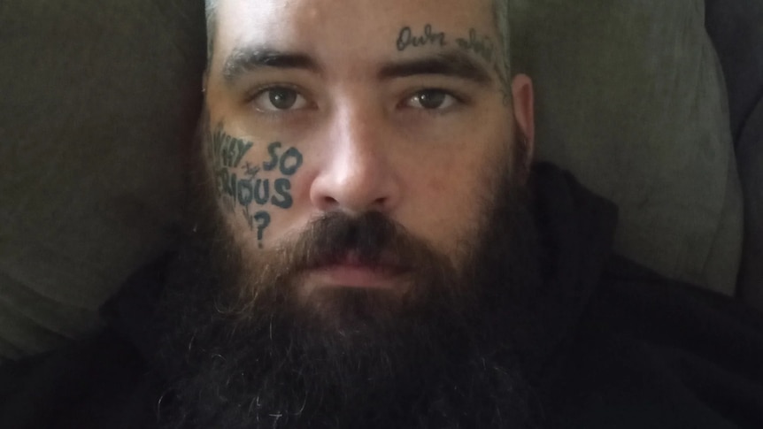 A bald, bearded white man in his late 20s with tattoos on his face.