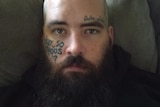 A bald, bearded white man in his late 20s with tattoos on his face.