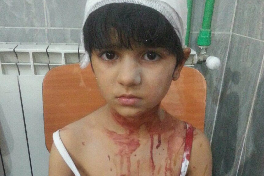A six-year-old girl injured in Aleppo.