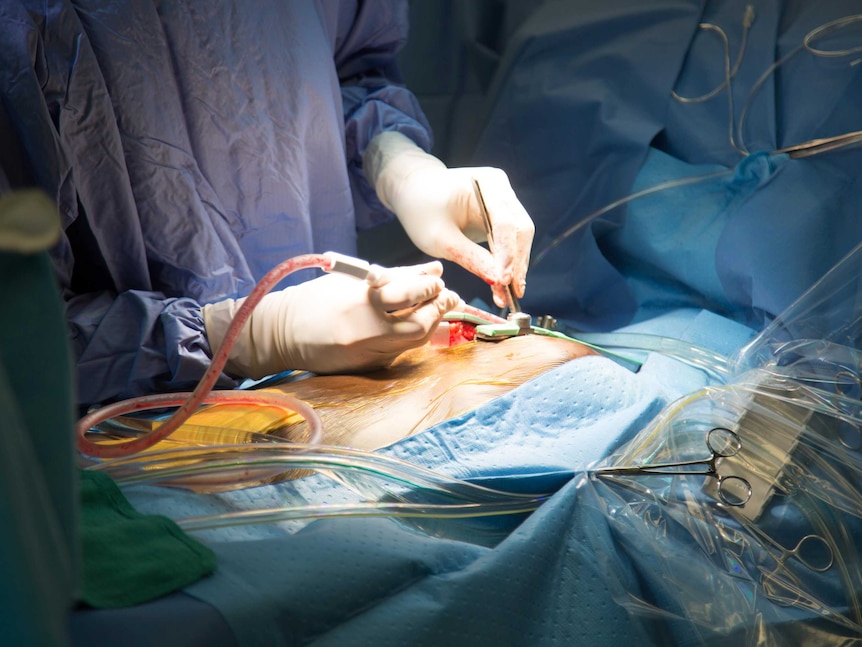 A surgeon performs open heart surgery.
